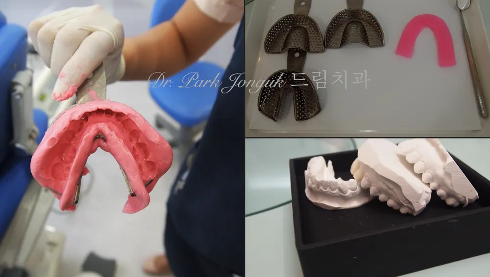 좋은 라미네이트란 무엇일까? 본문 사진 3