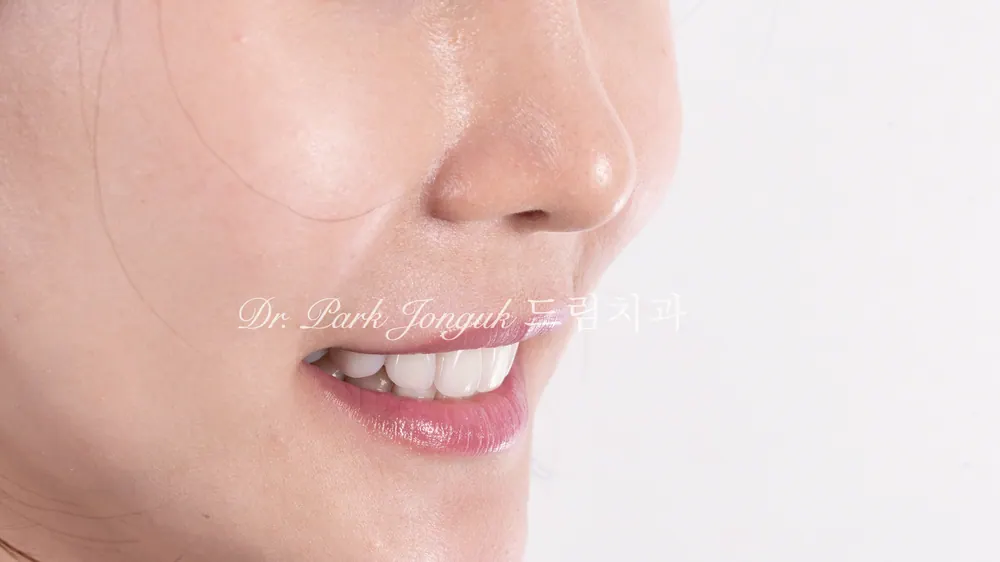 말 안 하면 모르는 자연스러운 다층구조 라미네이트 본문 사진 10