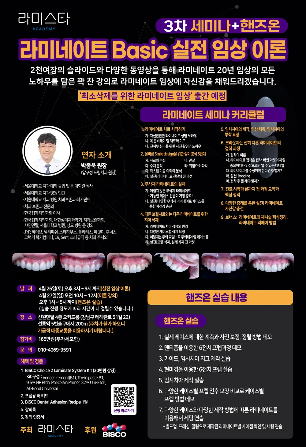 치과의사들도 궁금해하는 무삭제 라미네이트 본문 사진 15