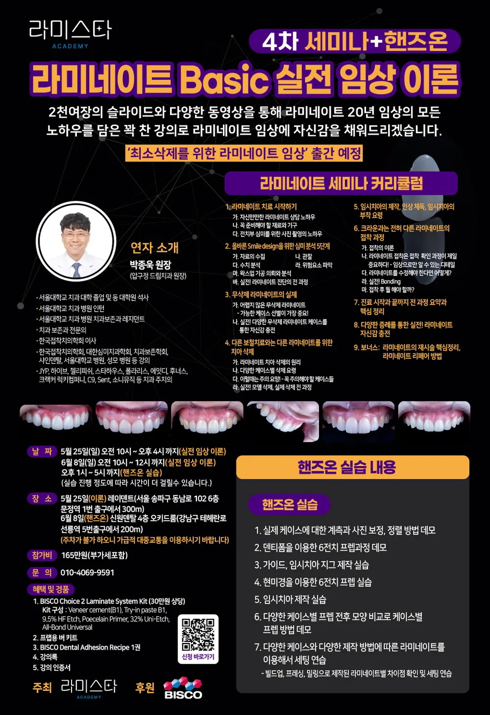 라미네이트 제작 방법에 따른 결과물 본문 사진 7