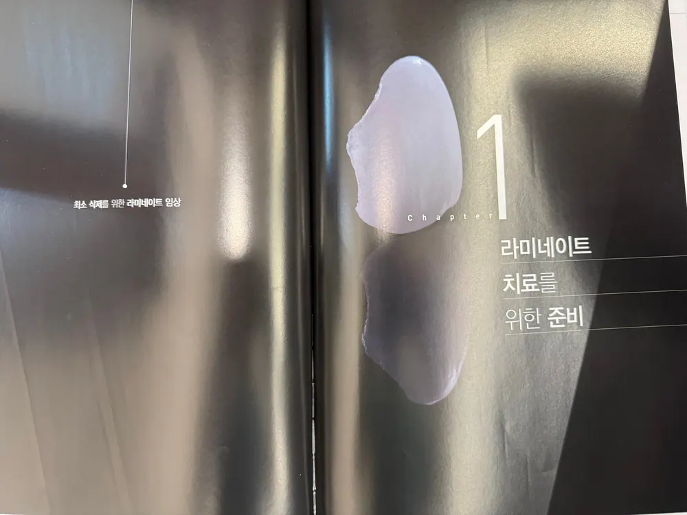 최소삭제를 위한 라미네이트 임상 본문 사진 2