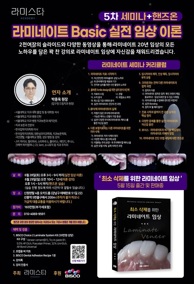 최소삭제를 위한 라미네이트 임상 본문 사진 11