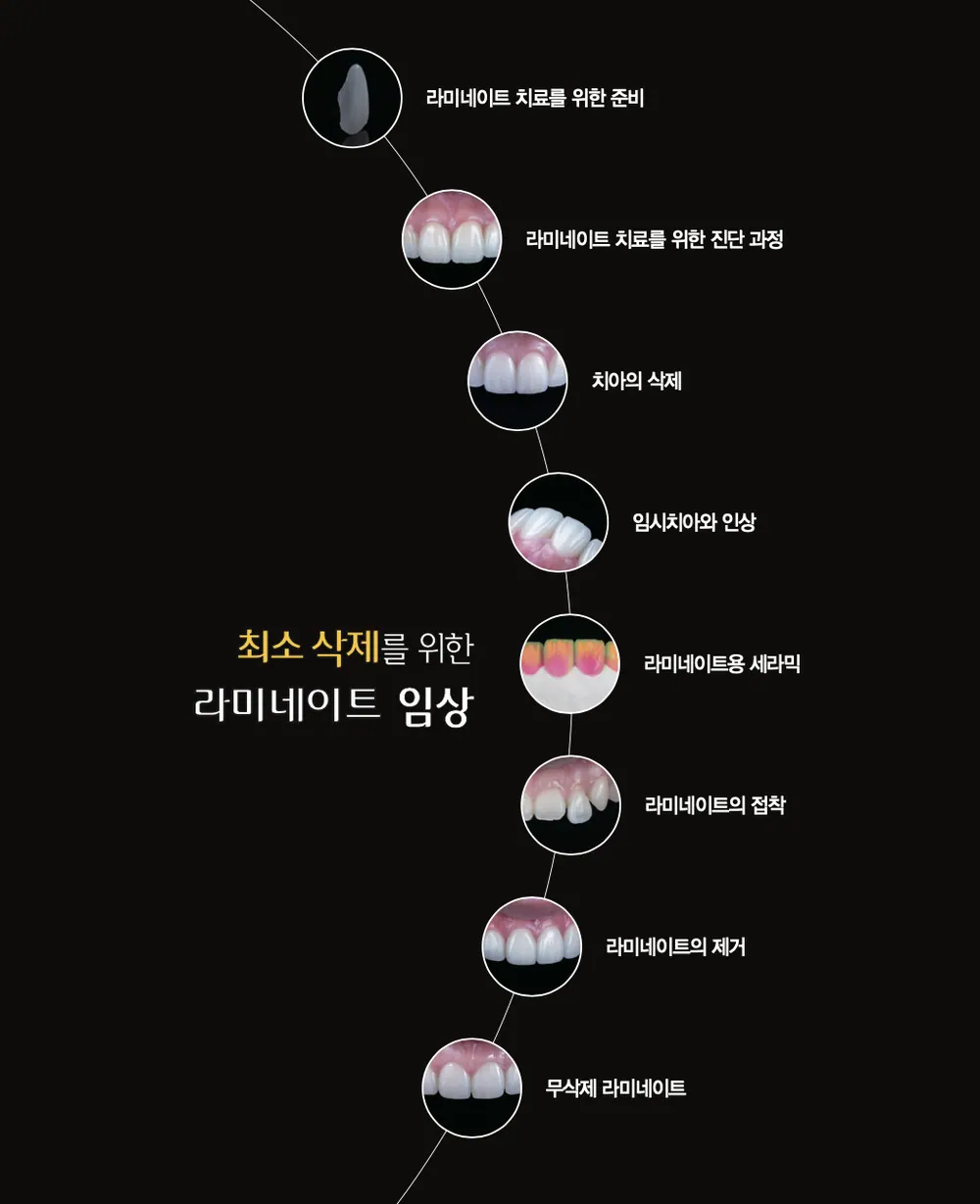 라미스타 아카데미 - 치과의사를 위한 라미네이트 강의 본문 사진 2