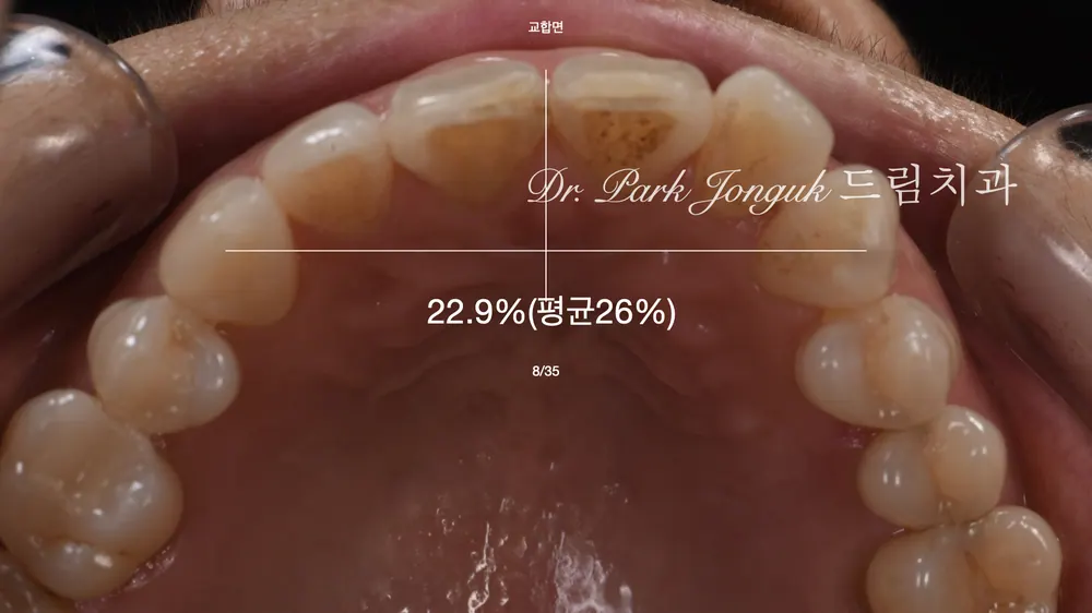 60대 블랙트라이앵글 라미네이트