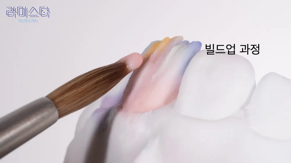 자연스러운 앞니 라미네이트의 제작과정