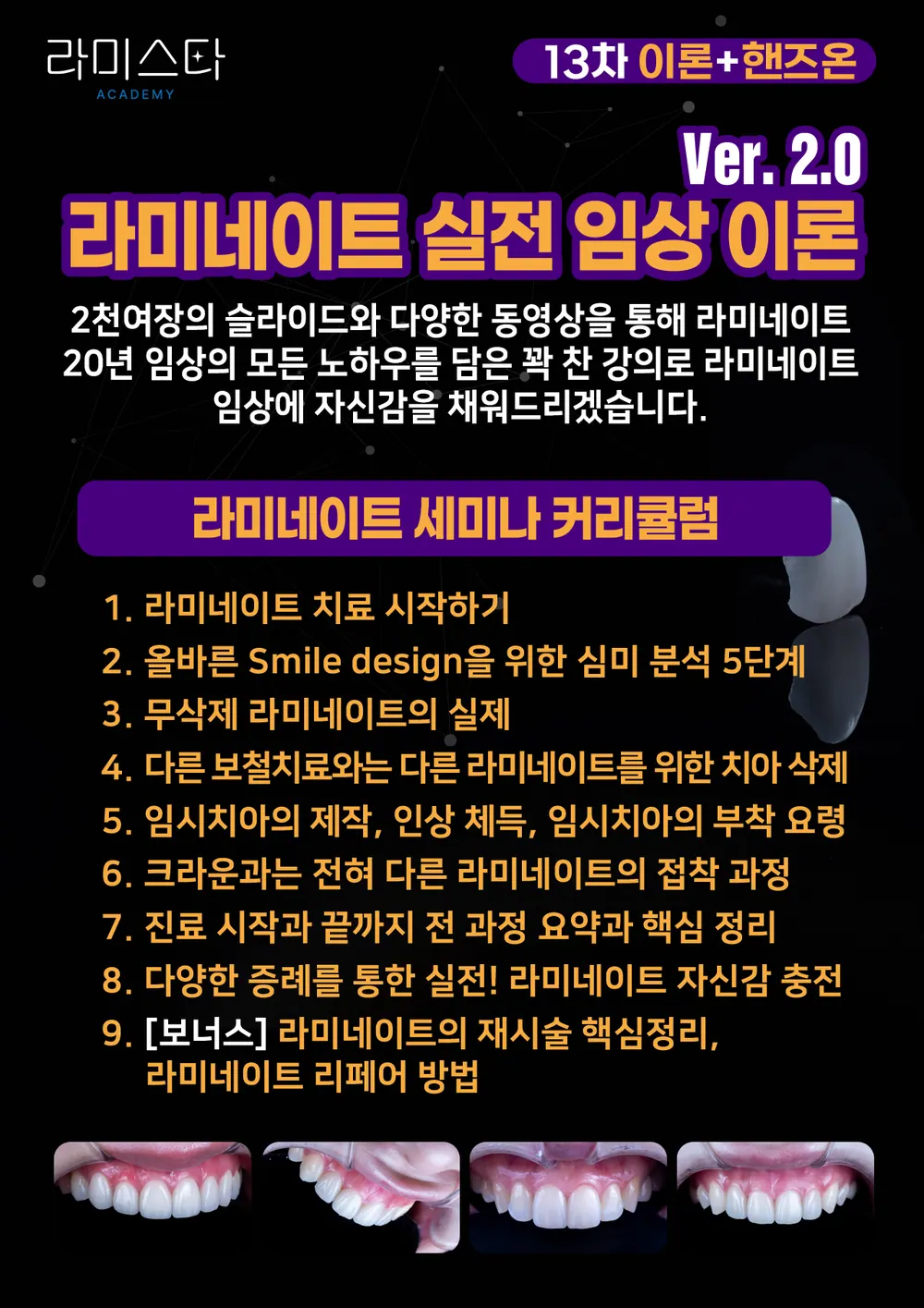 50대 60대 치아 누렇게 변하는 이유, 라미네이트로 젊어질 수 있나요? 본문 사진 12