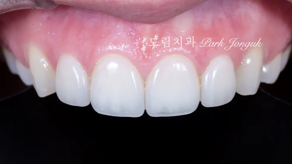 라미네이트 수명, 얼마나 갈까요? 20년 경험이 알려드립니다 본문 사진 7