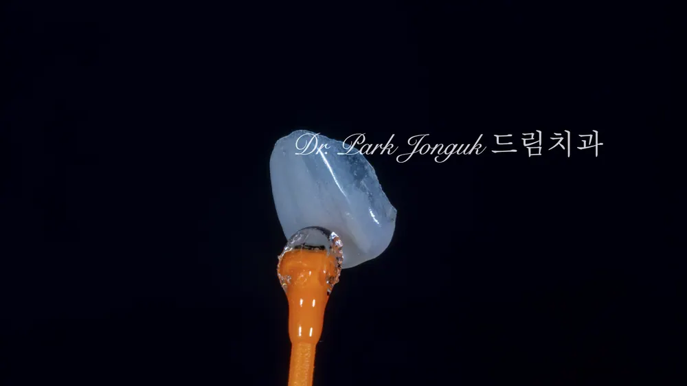 [사진 2] 핸드메이드로 만들어진 얇지만 자연스러운 표현이 들어간 라미네이트