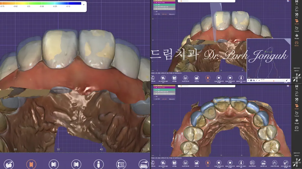 정밀한 진단과정이 필수