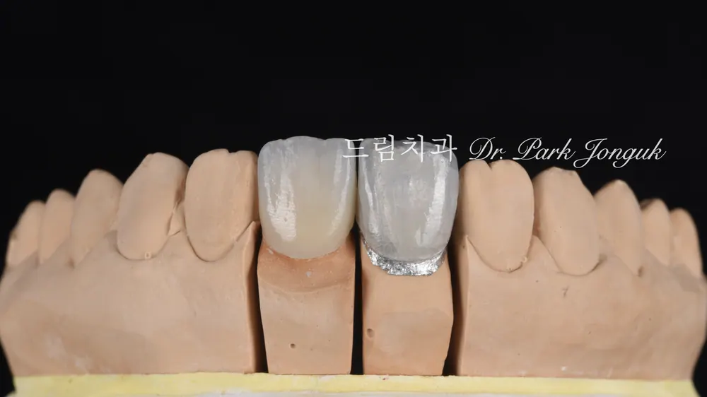 라미네이트 가격은 왜 천차만별일까 - 비용을 결정하는 5가지 요소 본문 사진 3