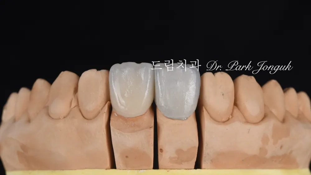 라미네이트 가격은 왜 천차만별일까 - 비용을 결정하는 5가지 요소 본문 사진 5