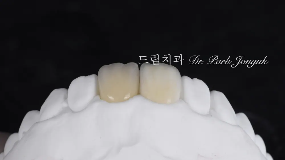 라미네이트 가격은 왜 천차만별일까 - 비용을 결정하는 5가지 요소 본문 사진 7