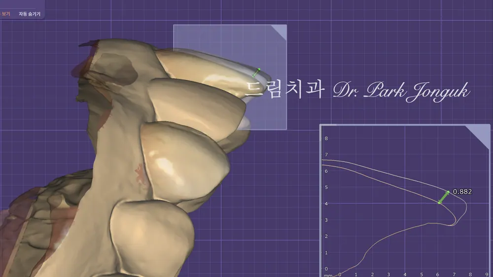 라미네이트 가격은 왜 천차만별일까 - 비용을 결정하는 5가지 요소 본문 사진 9