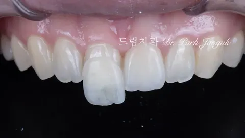 라미네이트 가격은 왜 천차만별일까 - 비용을 결정하는 5가지 요소