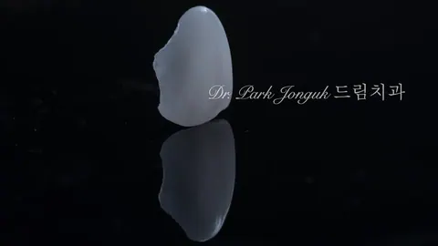 앞니가 고민이라면 라미네이트 vs 교정, 뭘 먼저 해야 할까요?