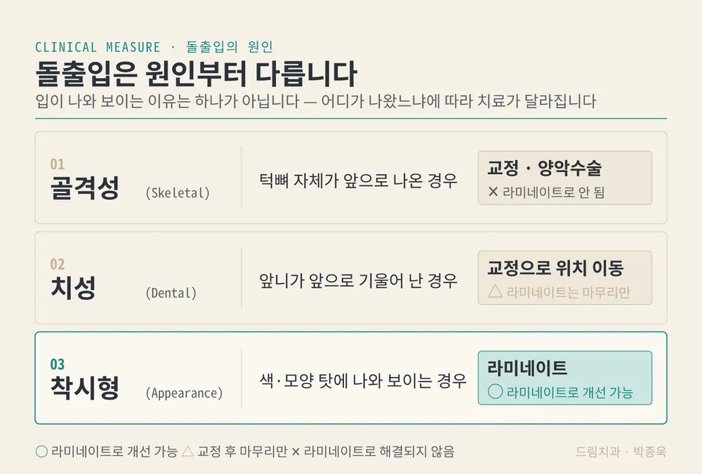 돌출입, 라미네이트로 되나요? 본문 사진 2