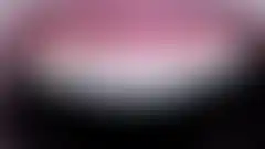 상악 4전치 미세삭제 라미네이트 치료 결과. 자연치아와 조화를 이루는 색감 재현, 20년 임상 작품 (로그인 후 조회 가능, 현재 흐림 처리)