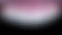 상악 4전치 미세삭제 라미네이트 치료 결과. 최소 삭제로 자연치 보존한 다층 빌드업 케이스 (로그인 후 조회 가능, 현재 흐림 처리)