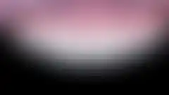상악 2전치 무삭제 라미네이트 치료 결과. 치아 삭제 없이 심미 개선한 노프렙 케이스 (로그인 후 조회 가능, 현재 흐림 처리)