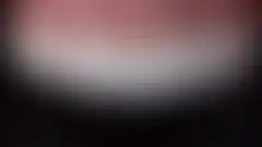 상악 6전치 미세삭제 라미네이트 치료 결과. 자연스러운 투명감과 전치부 조화 (로그인 후 조회 가능, 현재 흐림 처리)