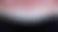 상악 2전치 라미네이트 재치료 결과. 기존 보철물 교체 후 자연스러운 마무리 (로그인 후 조회 가능, 현재 흐림 처리)