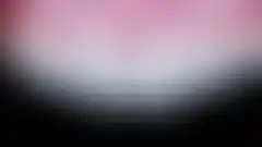 상악 4전치 라미네이트 재치료 결과. 변색·부자연 보철물 교체 임상 케이스 (로그인 후 조회 가능, 현재 흐림 처리)