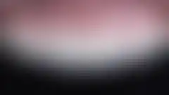 상악 4전치 미세삭제 라미네이트 치료 결과. 정성스러운 수작업 세라믹 빌드업 (로그인 후 조회 가능, 현재 흐림 처리)