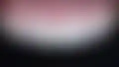 자연스러운 라미네이트 치료 결과. 4~5가지 세라믹 파우더 다층 수작업 제작 (로그인 후 조회 가능, 현재 흐림 처리)