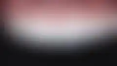 박종욱 원장 라미네이트 임상 케이스. 상악 전치부 심미 개선, 최소 침습 (로그인 후 조회 가능, 현재 흐림 처리)