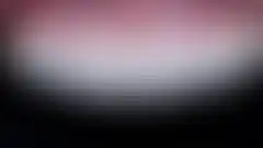 최소삭제 라미네이트 치료 결과. 치아 보존과 심미 양립 임상 케이스 (로그인 후 조회 가능, 현재 흐림 처리)