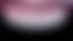 다층 빌드업 라미네이트 치료 결과. 자연치아와 구분되지 않는 심미 완성 (로그인 후 조회 가능, 현재 흐림 처리)