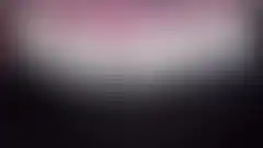 변색되고 마모된 앞니를 밝고 자연스럽게 개선한 라미네이트 실제 증례: 치료 후 (로그인 후 조회 가능, 현재 흐림 처리)