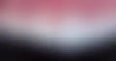 어둡고 고르지 않던 앞니의 색과 형태를 정돈한 라미네이트 실제 증례: 치료 후 (로그인 후 조회 가능, 현재 흐림 처리)