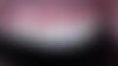 치아를 거의 삭제하지 않고 형태를 살린 무삭제 라미네이트 실제 증례: 치료 후 (로그인 후 조회 가능, 현재 흐림 처리)