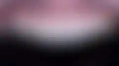 작고 짧던 앞니를 무삭제 라미네이트로 자연스럽게 키운 실제 증례: 치료 후 (로그인 후 조회 가능, 현재 흐림 처리)