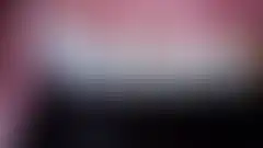 누렇고 고르지 않던 앞니를 삭제를 최소화해 밝게 정돈한 실제 증례: 치료 후 (로그인 후 조회 가능, 현재 흐림 처리)