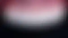 대문니만 크고 옆니가 작던 이른바 토끼이의 좌우 폭 비율을 다시 잡은 실제 증례: 치료 후 (로그인 후 조회 가능, 현재 흐림 처리)