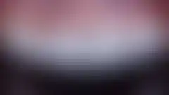 치아 사이 잇몸이 내려앉아 생긴 검은 삼각형(블랙 트라이앵글)을 닫은 실제 증례: 치료 후 (로그인 후 조회 가능, 현재 흐림 처리)