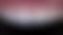 깨지고 마모된 앞니 끝을 복원한 미세삭제 라미네이트 실제 증례: 치료 후 (로그인 후 조회 가능, 현재 흐림 처리)