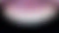 역류성 식도염으로 부식되고 깨진 앞니를 최소 삭제로 복원한 실제 증례: 치료 후 (로그인 후 조회 가능, 현재 흐림 처리)