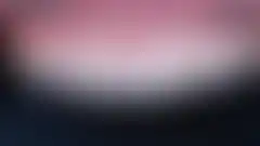 심하게 닳아 짧아진 앞니의 길이와 투명감을 되살린 실제 증례: 치료 후 (로그인 후 조회 가능, 현재 흐림 처리)