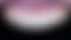 위산 역류로 부식되고 끝이 깨진 앞니를 다시 세운 실제 증례: 치료 후 (로그인 후 조회 가능, 현재 흐림 처리)