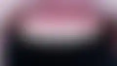 레이저 제거 후 재시술 (완성) (로그인 후 조회 가능, 현재 흐림 처리)