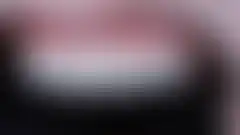 CASE 01 무삭제 라미네이트. 자연스러움을 잘 살린 아름다운 치아, 좌측면: 두께감 확인 (로그인 후 조회 가능, 현재 흐림 처리)