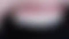 CASE 01 무삭제 라미네이트. 자연스러움을 잘 살린 아름다운 치아, 우측면: 두께감 확인 (로그인 후 조회 가능, 현재 흐림 처리)