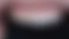 무삭제 라미네이트: 시적(try-in) (로그인 후 조회 가능, 현재 흐림 처리)