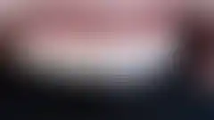 CASE 01 무삭제 라미네이트. 자연스러움을 잘 살린 아름다운 치아, 시적(try-in): 접착 전 확인 (로그인 후 조회 가능, 현재 흐림 처리)