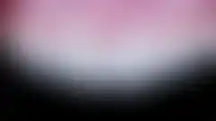 라미네이트 재시술 케이스 5 (재제작 후) (로그인 후 조회 가능, 현재 흐림 처리)